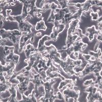 VCaP细胞、VCaP细胞、VCaP细胞