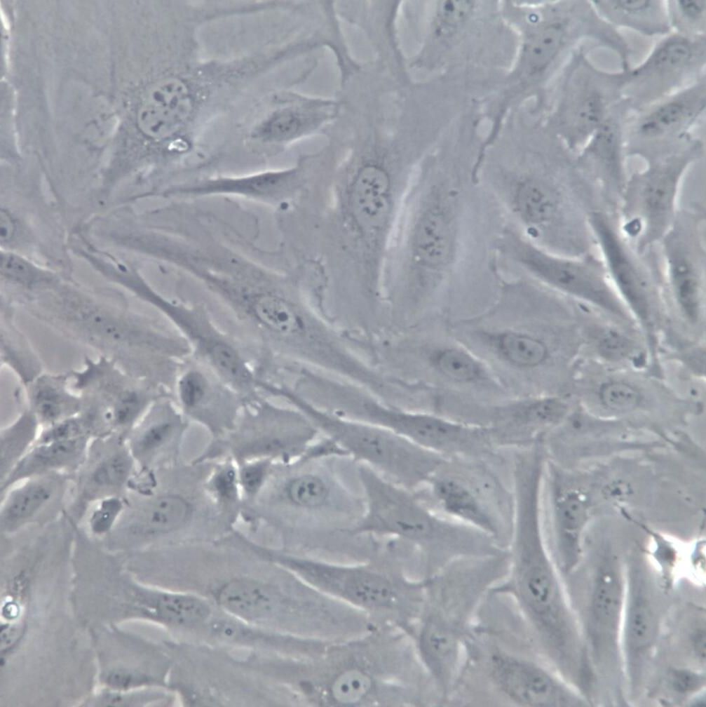 sw1353细胞系、sw1353细胞、sw1353骨肉瘤细胞