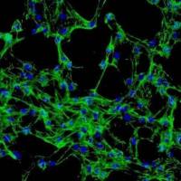 HCC4006 人肺癌腺癌细胞