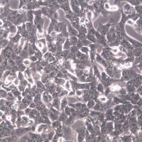 Hepa 1-6、Hepa 1-6、Hepa 1-6细胞