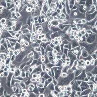 AU565 人乳腺癌细胞