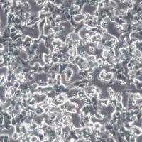 3LL；小鼠肺癌细胞、3LL细胞、3LL