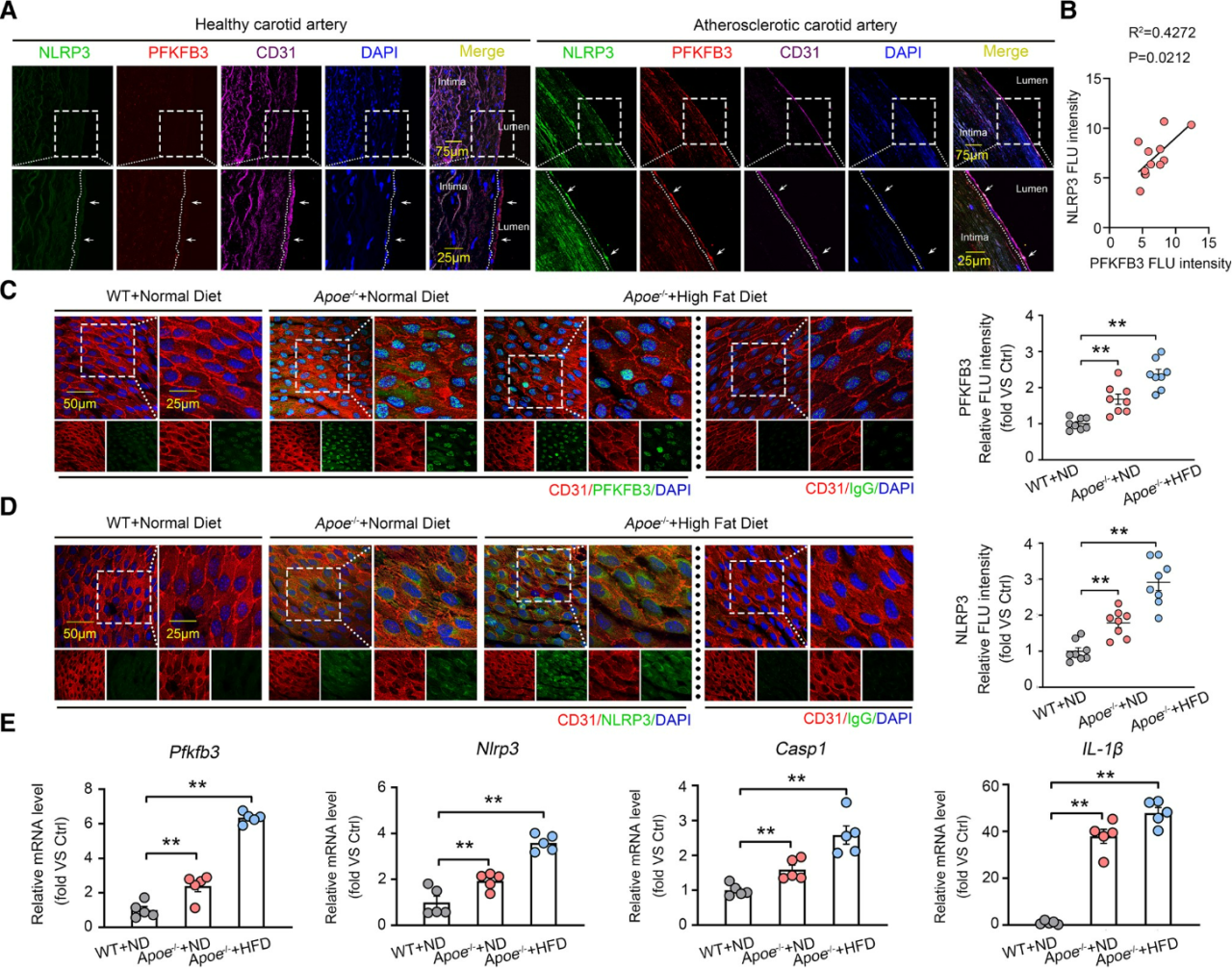 广州医科大学徐益鸣团队发现动脉粥样硬化调控新机制
