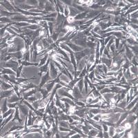 HBZY-1大鼠肾小球系膜细胞、HBZY-1细胞、HBZY1