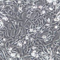 MB49细胞、MB49细胞株、MB49细胞系