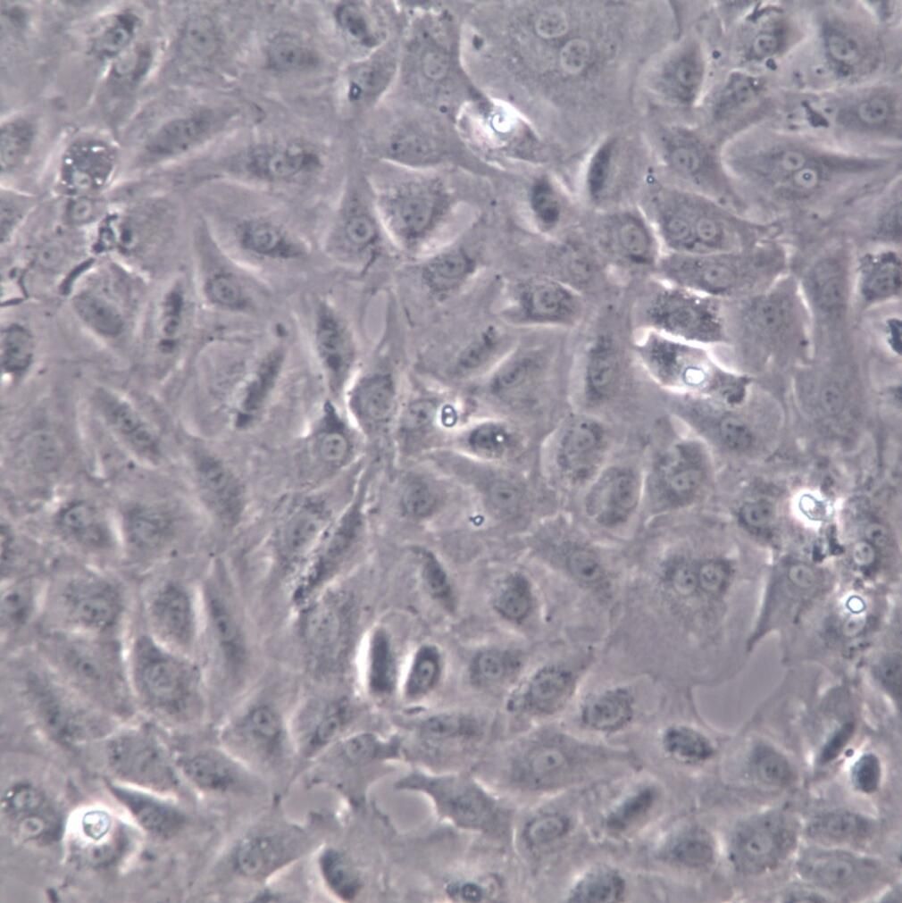  BALB/3T3 clone A31细胞、BALB/3T3 clone A31细胞