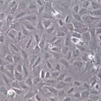  BALB/3T3 clone A31细胞、BALB/3T3 clone A31细胞