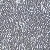 HCMEC/D3细胞、HCMEC/D3细胞系、HCMEC/D3脑微血管内皮细胞