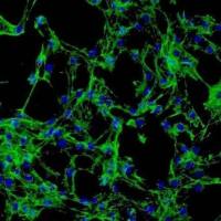 NCI-H1573 人肺癌腺癌细胞