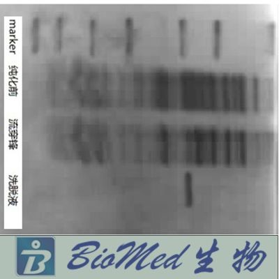 蛋白表达（原核和酵母表达体系）