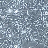 TC-1;小鼠肺上皮细胞、TC-1细胞