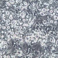 OE19 细胞、OE19 细胞系、OE19 食管癌细胞