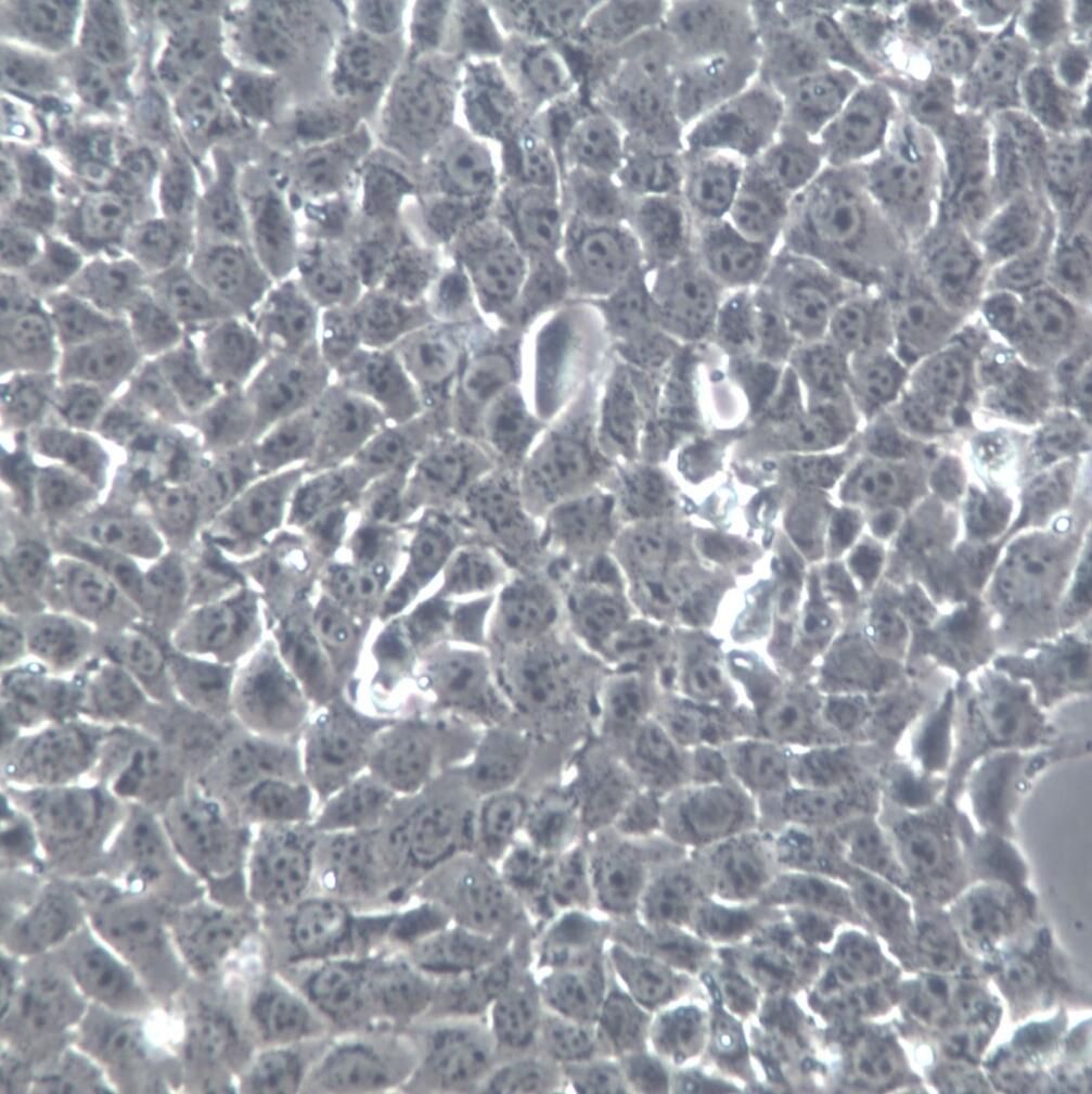 4T1细胞、4T1细胞、4T1细胞