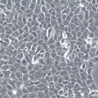 4T1细胞、4T1细胞、4T1细胞