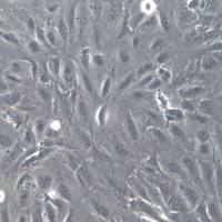 SNU423细胞系、SNU423细胞、SNU423肝癌细胞