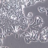 HEPG2-LUC细胞株、HEPG2-LUC细胞、HEPG2-LUC细胞系