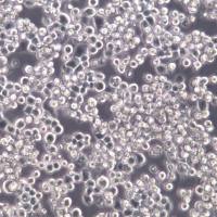 U14小鼠宫颈癌细胞;U14细胞、U-14、U14