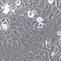 SW1990、SW-1990；人胰腺癌细胞