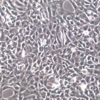 HSC-T6大鼠肝星形细胞、HSC-T6细胞系、HSC-T6细胞