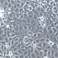 TU686 细胞、TU686 细胞系、TU686 喉癌细胞