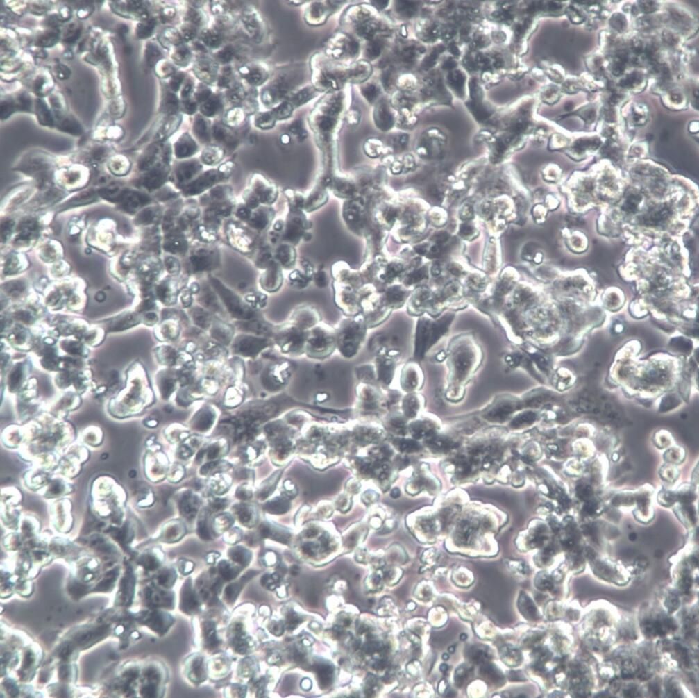 3LL细胞、3LL、3LL细胞