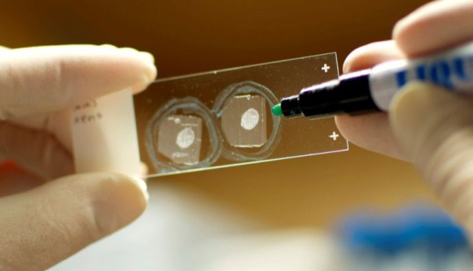 答应我，看完再做IHC（下）