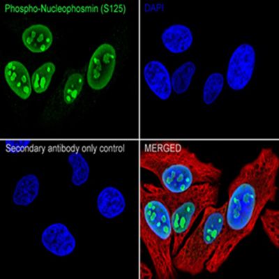 Plexin A1 Recombinant Rabbit mAb(重组兔单抗)