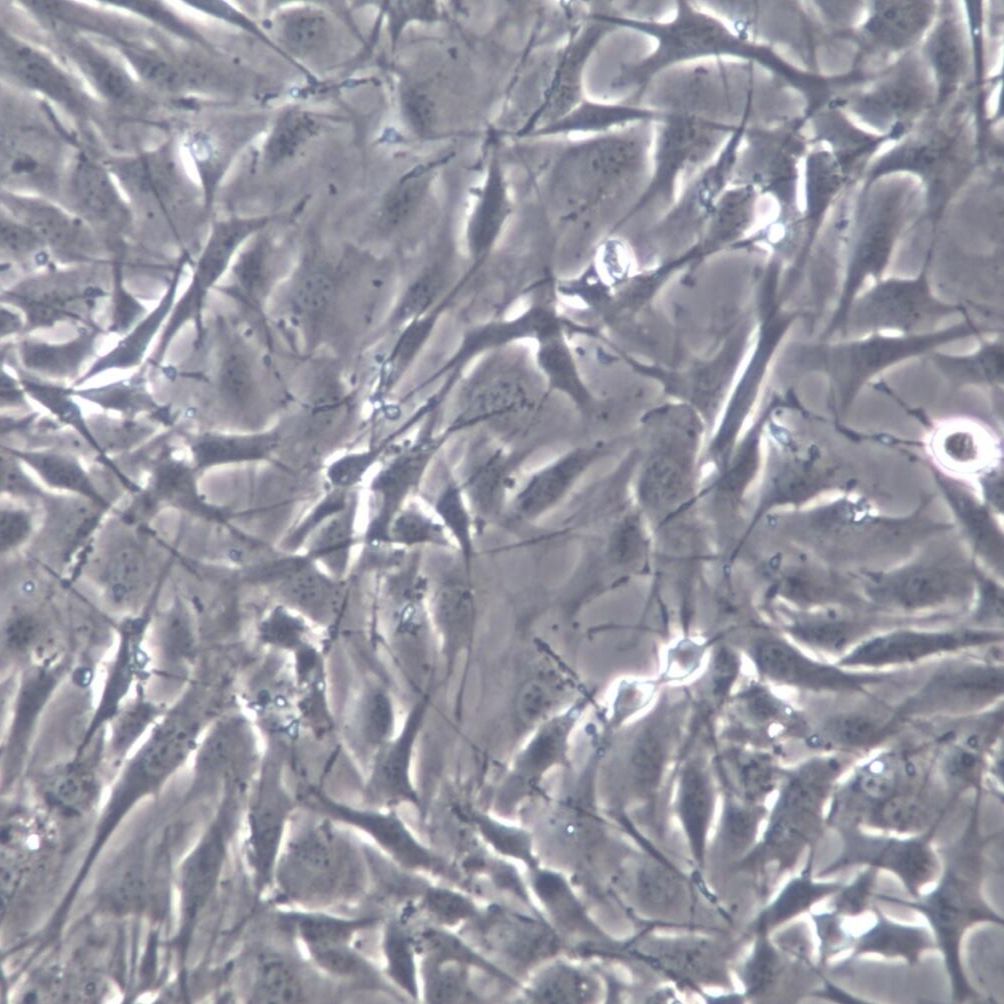 MC3T3-E1小鼠胚胎成骨细胞前体细胞；MC3T3-E1