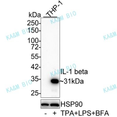 IL-1 beta Mouse mAb(重组鼠单抗)WB,ELISA,IHC-P