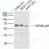 Traumatic Brain Injury Biomarker Antibody Sampler Kit