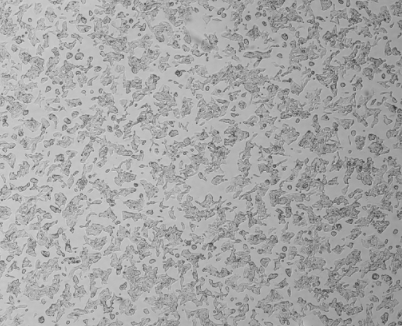 细胞攻略 | VCaP(人前列腺癌细胞)细胞培养教程