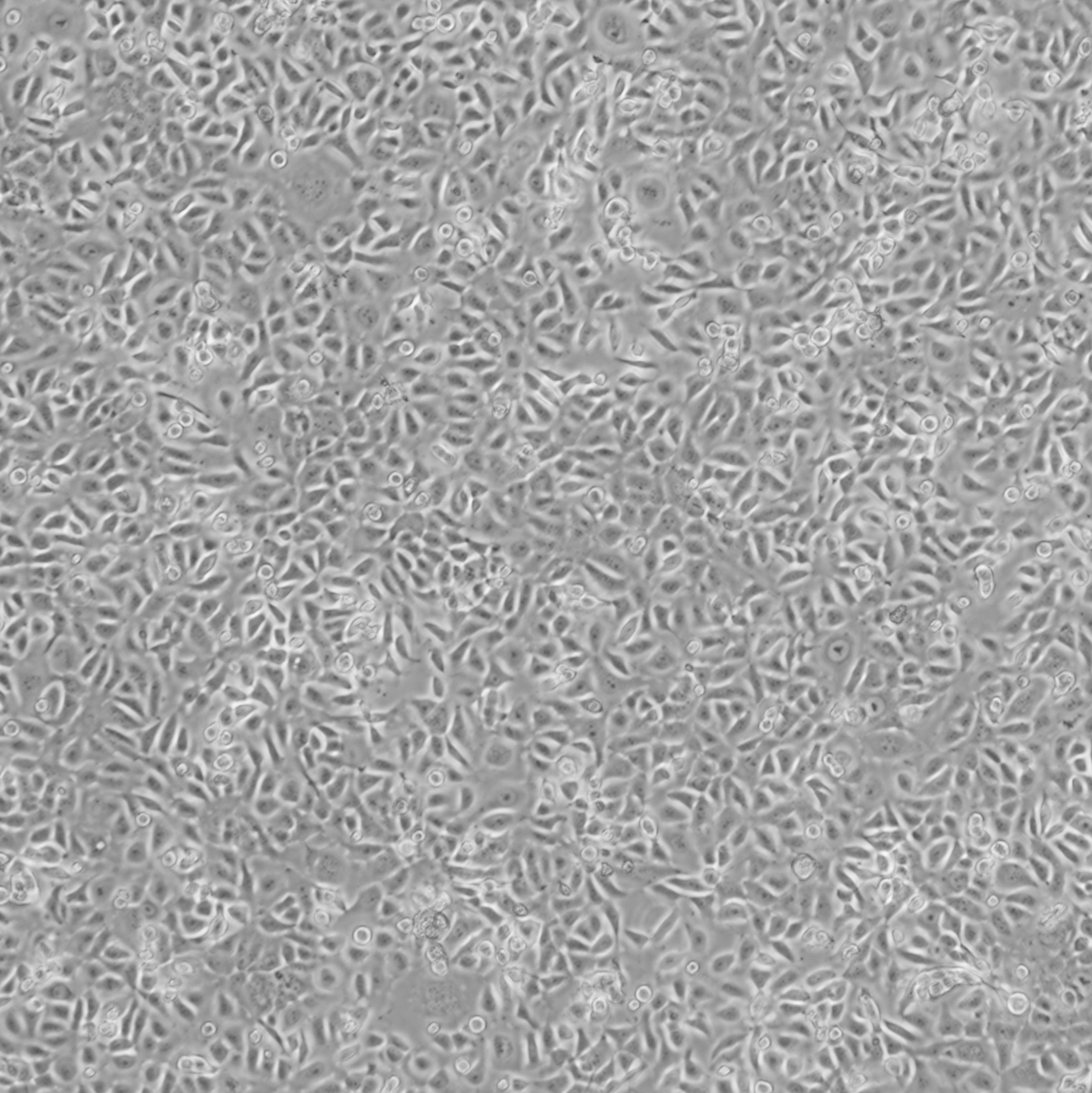 TE-9_人食管鳞状细胞癌细胞