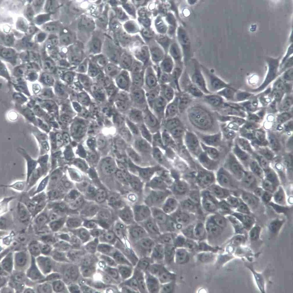 SAS 人舌鳞状癌细胞
