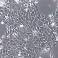 SAS 人舌鳞状癌细胞