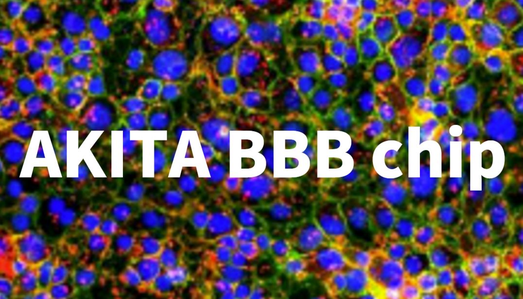 AKITA器官芯片 | iPSC来源的神经类器官与血脑屏障模型