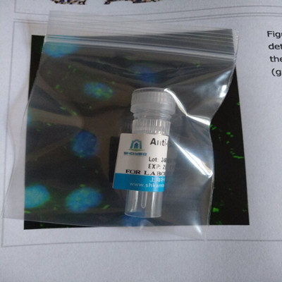 beta III Tubulin/TUBB3 Rabbit