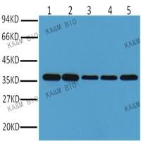 SUMO2 Mouse mAb(Clone:SPM621)