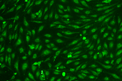 人脐静脉内皮细胞(HUVEC)