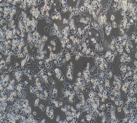 MB-49 小鼠膀胱癌细胞传代/复苏技巧