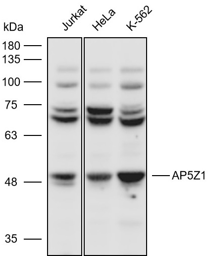 Anti-AP5Z1 Polyclonal Antibody