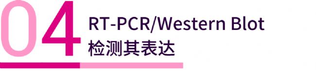 实验操作 | 质粒构建、转化、提取、鉴定、转染、测定(完整版)| MedChemExpress (MCE)