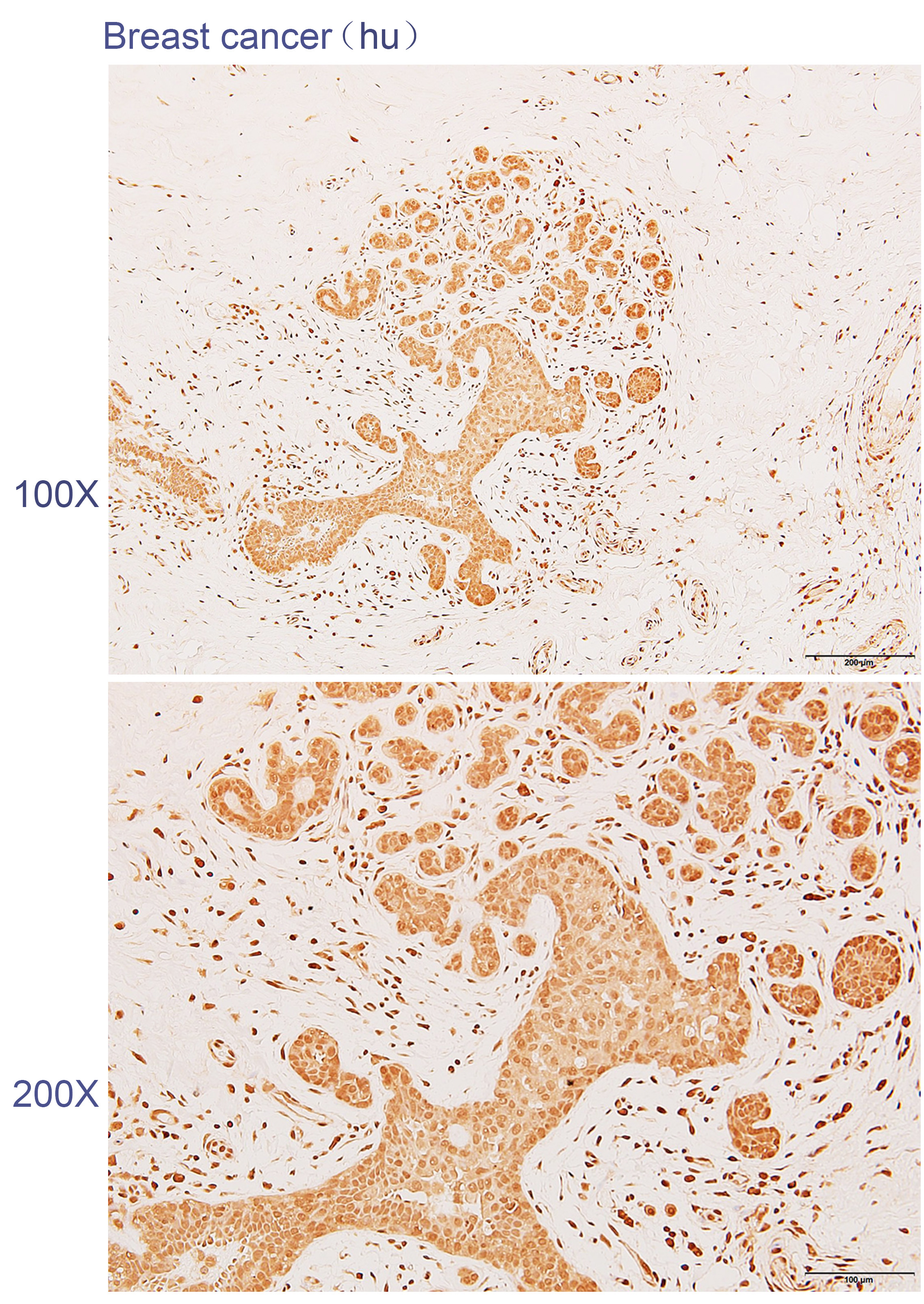 Anti-AP5Z1 Polyclonal Antibody