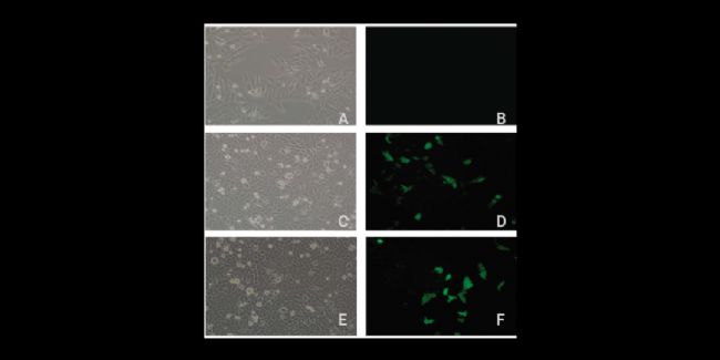 实验操作 | 质粒构建、转化、提取、鉴定、转染、测定(完整版)| MedChemExpress (MCE)