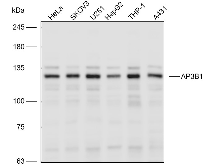 Anti-AP3B1 Polyclonal Antibody