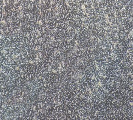 RM-1 小鼠前列腺癌细胞传代/复苏技巧