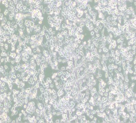 RAG 小鼠肾腺癌细胞传代/复苏技巧