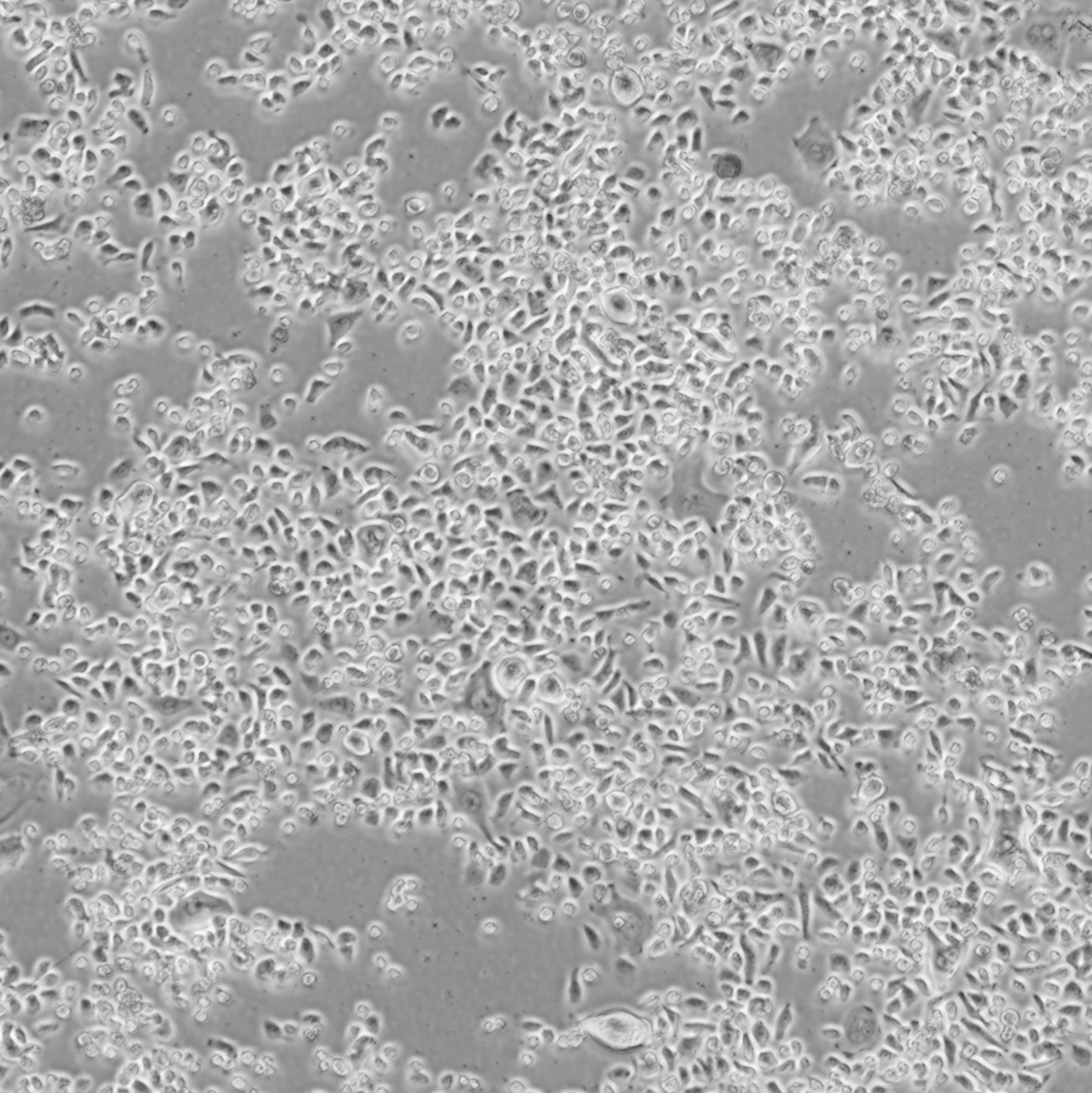 NCI-H1435 _人肺腺癌细胞