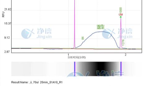 高通量声波基因组剪切仪对人全血DNA超声实验分享