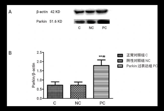 实验操作 | 质粒构建、转化、提取、鉴定、转染、测定(完整版)| MedChemExpress (MCE)