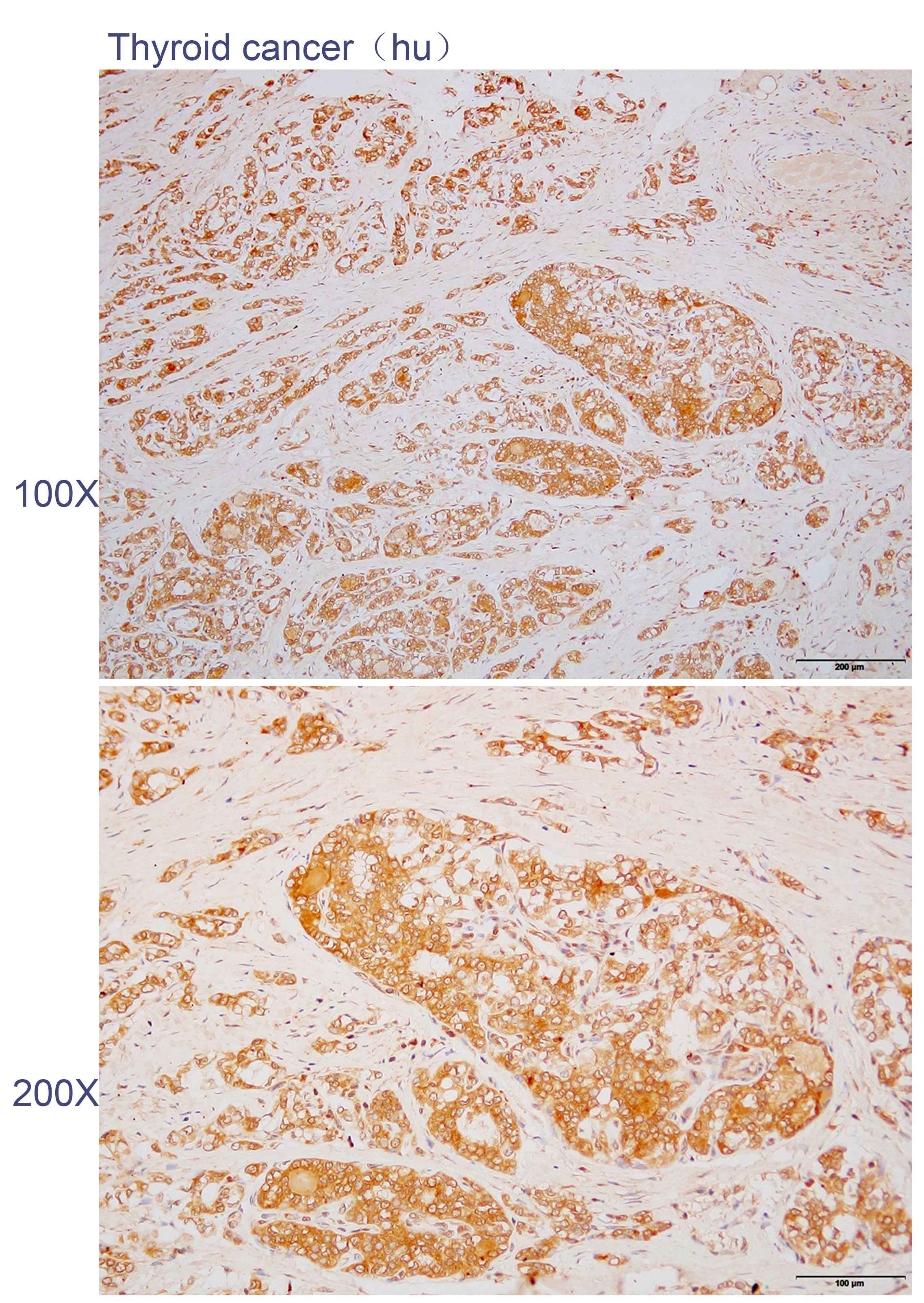 Anti-AP3B1 Polyclonal Antibody
